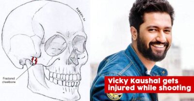 Vicky Kaushal Fractured His Cheekbones Gets 13 Stitches While Shooting For An Action Sequence RVCJ Media