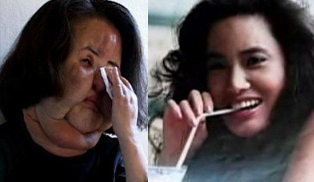 10 Times Celebrities' Plastic Surgeries Turned To Disasters RVCJ Media
