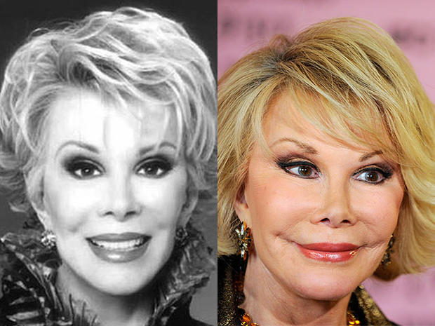 10 Times Celebrities' Plastic Surgeries Turned To Disasters - RVCJ Media