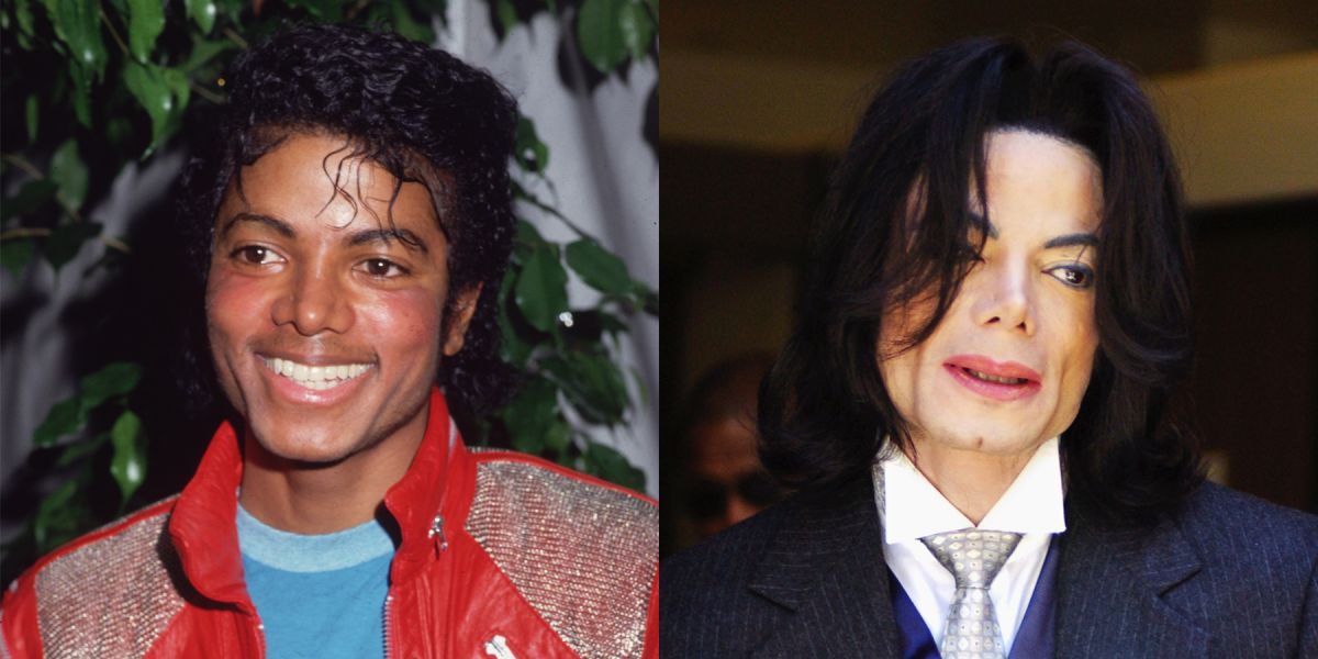 10 Times Celebrities' Plastic Surgeries Turned To Disasters - RVCJ Media