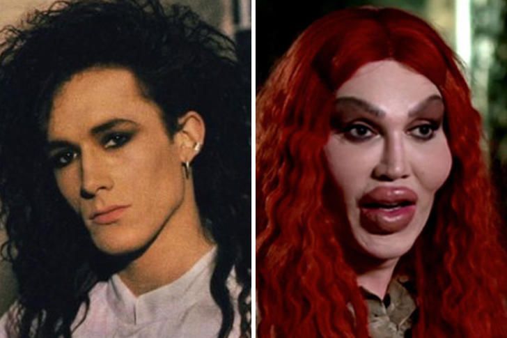 10 Times Celebrities' Plastic Surgeries Turned To Disasters - RVCJ Media