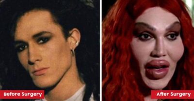 10 Times Celebrities' Plastic Surgeries Turned To Disasters RVCJ Media