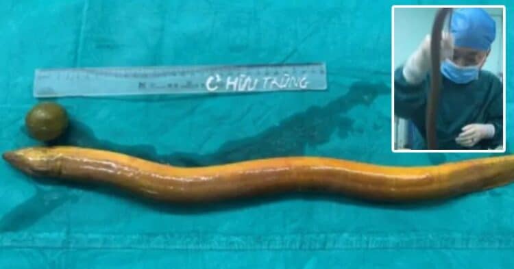 Bizarre- Surgeons Remove 1-Foot-Long Live Eel From Chinese Man’s Stomach 1 “You Are Done,” Dinesh Karthik Took A Dig At Ravi Shastri While Talking About His Last Test
