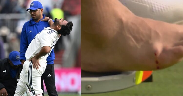 “Small, Fragile Bones….,” Ricky Ponting &Amp; Liam Dawson Paint Grim Picture Of Rishabh Pant’s Injury 1 “I Was Burying My Own….,” Palghar Woman Makes Victim’s Brother Lay Tiles After K*lling Husband