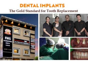 Dental Implants Explained Why They Are Now Considered the Gold Standard for Tooth Replacement